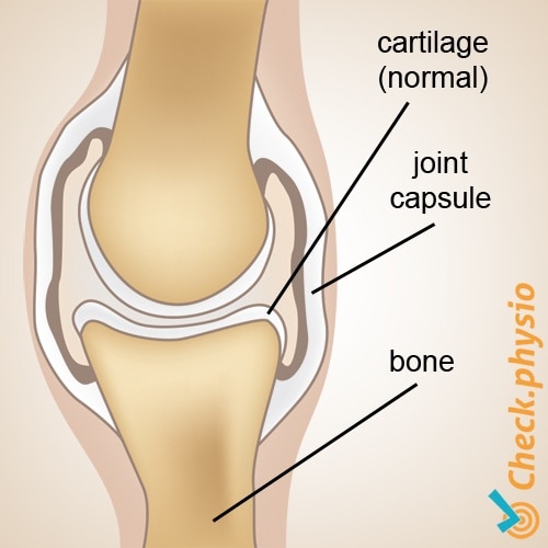 osteoarthritis anatomy healthy