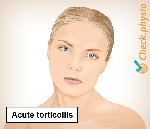 neck torticollis wry posture deviation