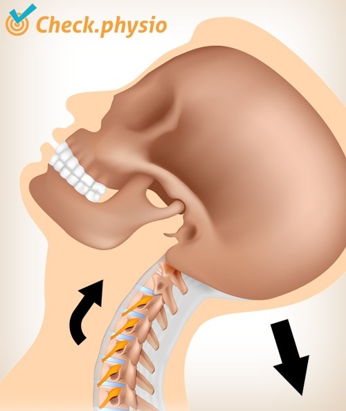 neck whiplash pain movement 3