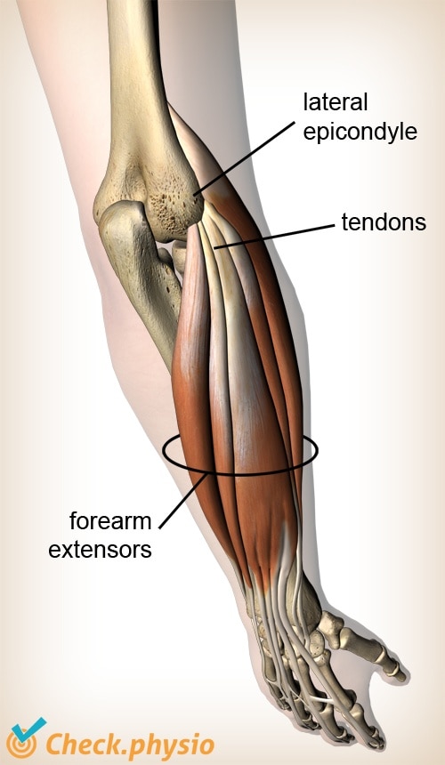 arm extensors