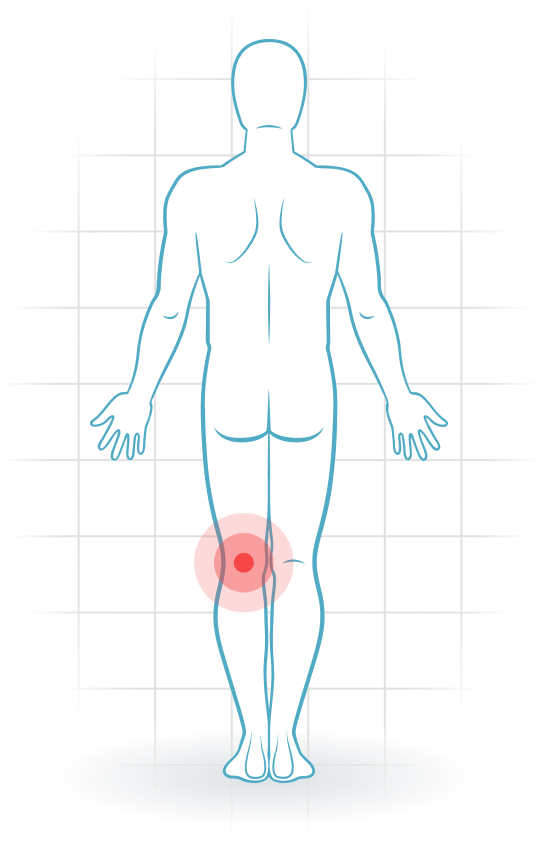 pijnlocatie Posterior cruciate ligament injury